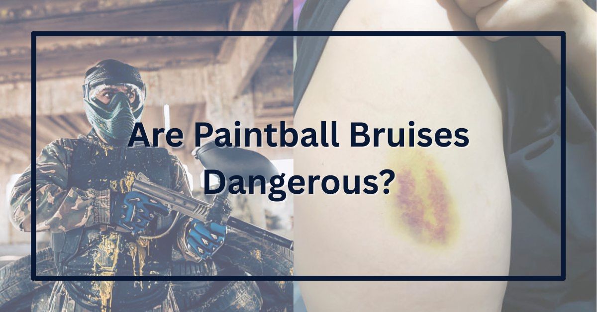 Are Paintball Bruises Dangerous?